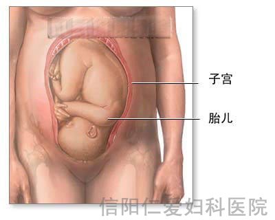 剖腹产全过程（图解）